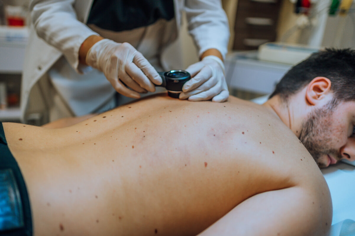 Μελάνωμα: Άνδρες και γυναίκες εμφανίζουν καρκίνο του δέρματος σε διαφορετικά σημεία του σώματος