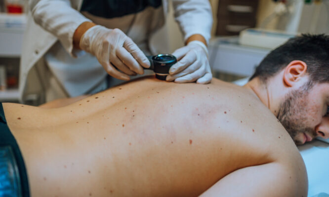 Μελάνωμα: Άνδρες και γυναίκες εμφανίζουν καρκίνο του δέρματος σε διαφορετικά σημεία του σώματος