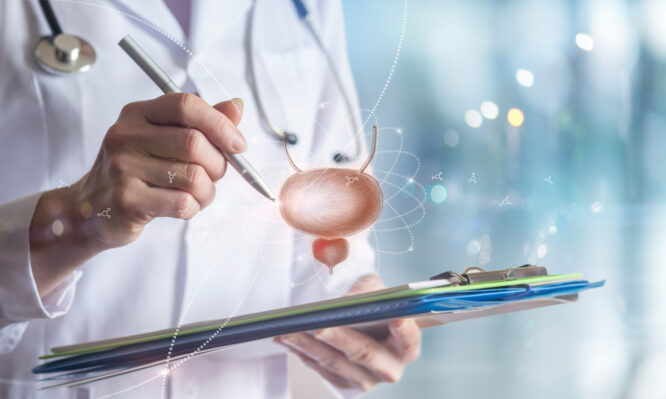 καρκίνος της ουροδόχου κύστης