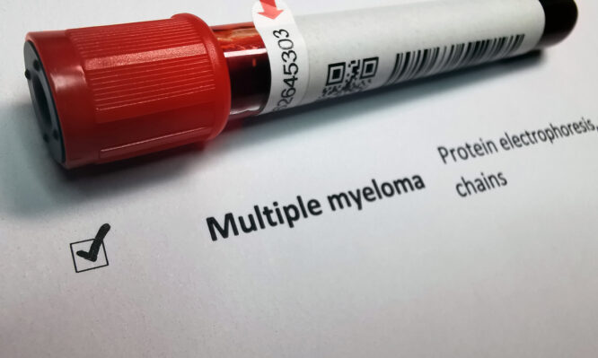 πολλαπλούν μυέλωμα