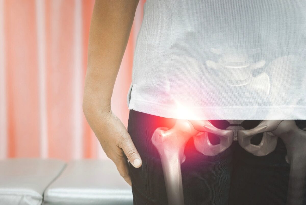 αρθροπλαστική