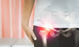 αρθροπλαστική