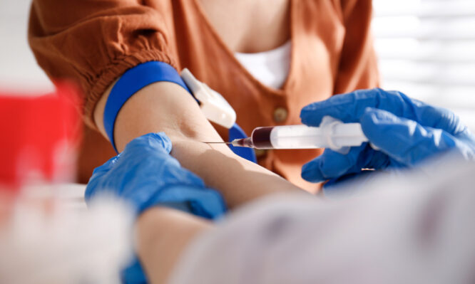 Αλτσχάιμερ