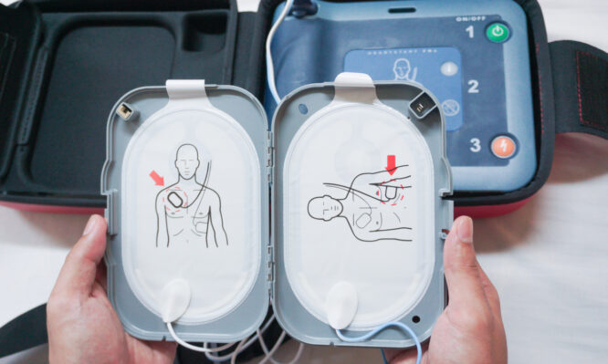 απινιδωτές