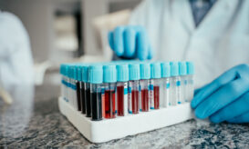 δρεπανοκυτταρική νόσος