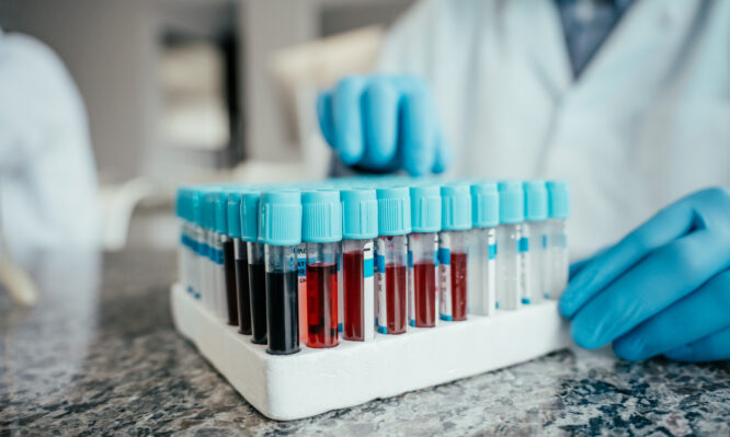 δρεπανοκυτταρική νόσος