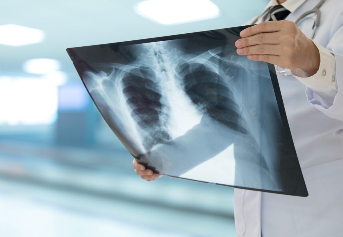 αναπνευστικά νοσήματα