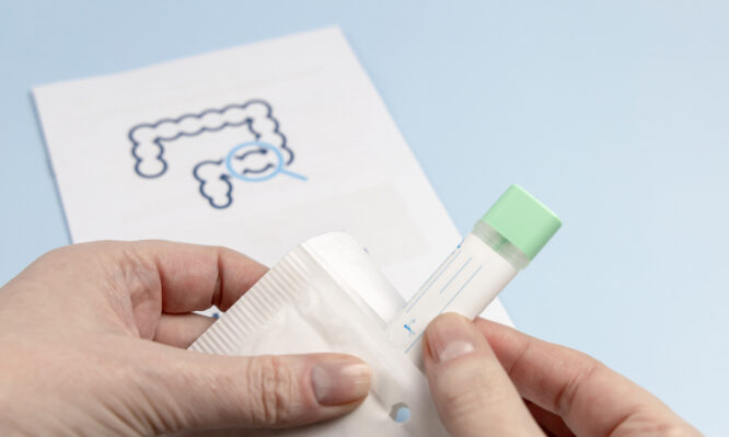 Καρκίνος παχέος εντέρου: Τα self tests είναι ο καλύτερος τρόπος προσυμπτωματικού ελέγχου, σύμφωνα με μελέτη