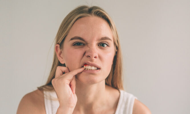 ούλα - αιμορραγία