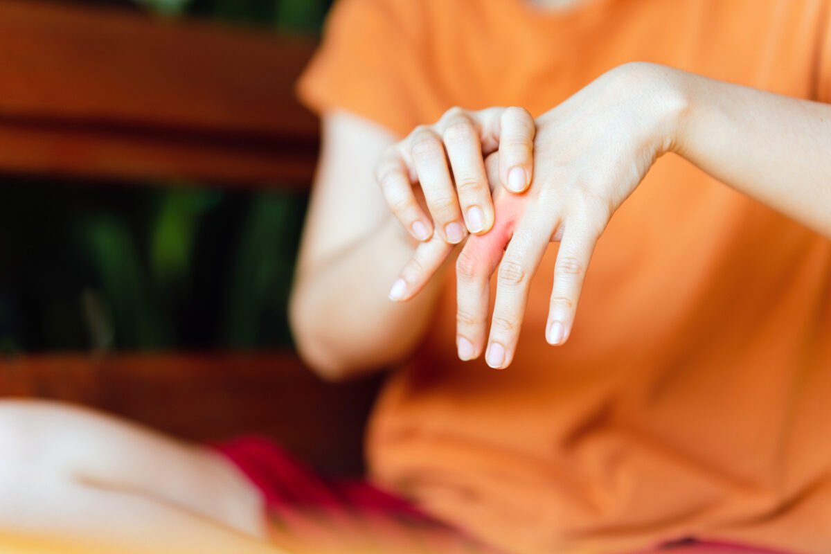 ρευματοειδής αρθρίτιδα