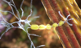 Πολλαπλή σκλήρυνση: Ελπίδα για μια νέα κατηγορία θεραπειών από τα αποτελέσματα νέας κλινικής μελέτης