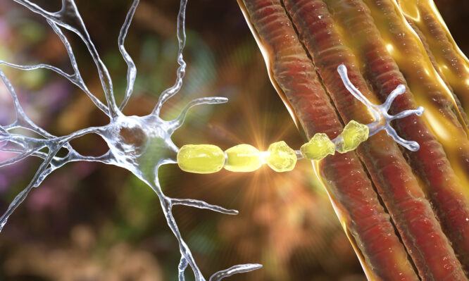 Πολλαπλή σκλήρυνση: Ελπίδα για μια νέα κατηγορία θεραπειών από τα αποτελέσματα νέας κλινικής μελέτης