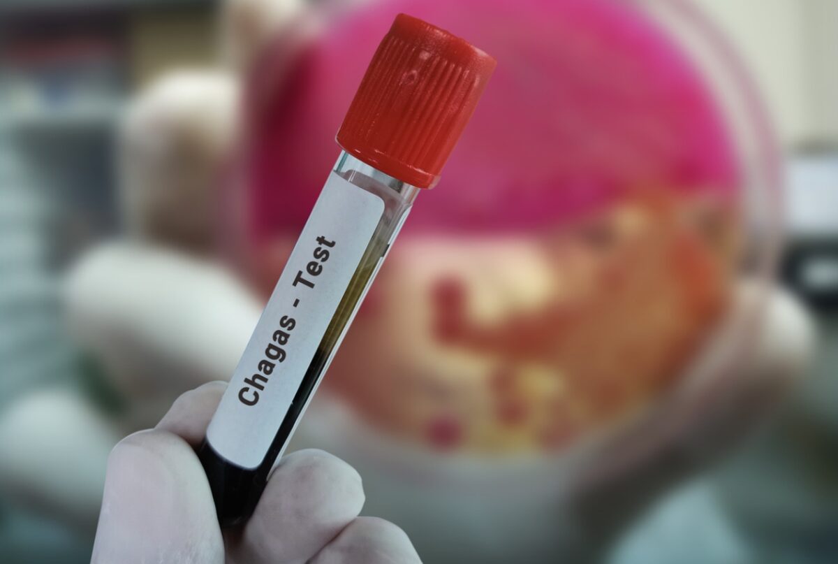 νόσος Chagas