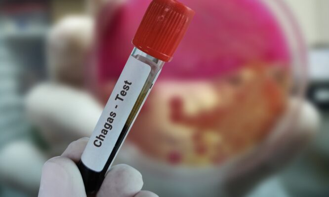 νόσος Chagas