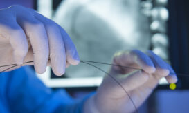 Πότε μπορεί να χρειαστεί κανείς στεντ (stent) και πότε δεν συνιστάται η τοποθέτησή του
