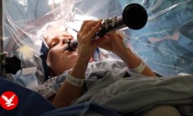 Γυναίκα με Πάρκινσον έπαιζε κλαρινέτο επί ώρες ενώ υποβαλλόταν σε χειρουργική επέμβαση στον εγκέφαλο (βίντεο)