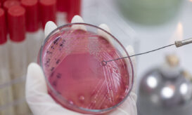 αντιβιοτικά