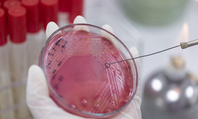 αντιβιοτικά