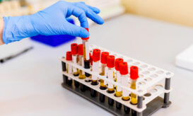 νανοσωματίδια