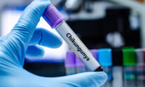 chikungunya