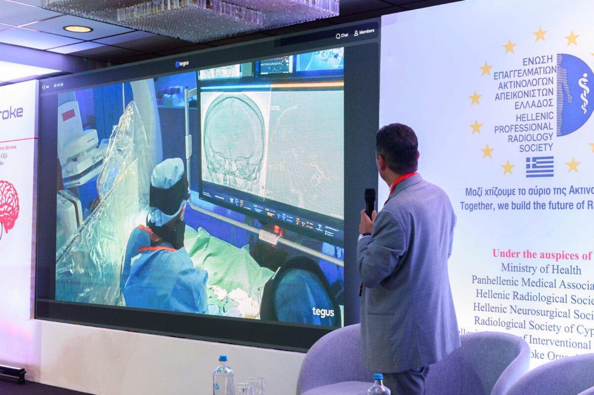 εγκεφαλικά