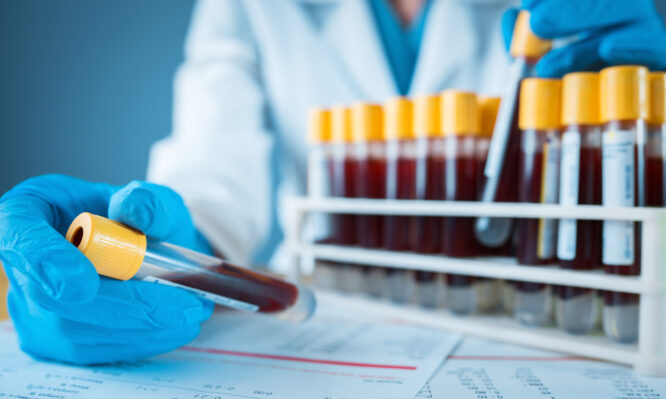 ερυθρά αιμοσφαίρια