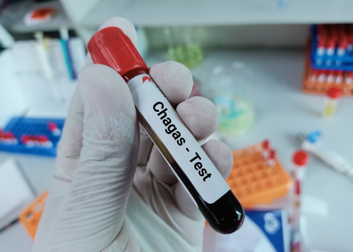 Chagas
