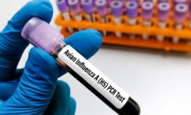 γρίπη των πτηνών