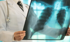 Φυματίωση: Σε επίπεδο ρεκόρ οι διαγνώσεις, αλλά οι θάνατοι μειώνονται, λέει ο ΠΟΥ