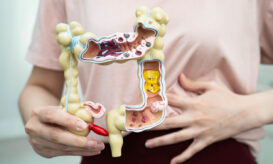 εκκολπώματα