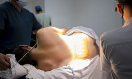 Επισκληρίδιος αναισθησία κατά τον τοκετό: Γιατί μπορεί να μην έχει το επιθυμητό αποτέλεσμα