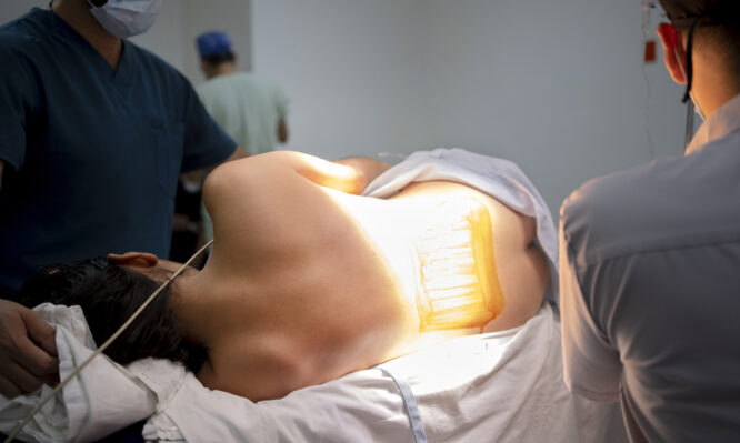 Επισκληρίδιος αναισθησία κατά τον τοκετό: Γιατί μπορεί να μην έχει το επιθυμητό αποτέλεσμα