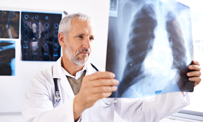 καρκίνος του πνεύμονα