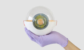 μεταμόσχευση