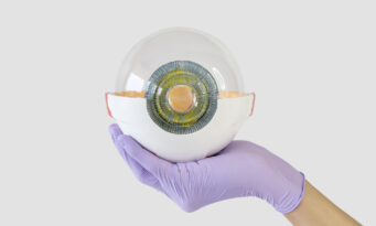 μεταμόσχευση