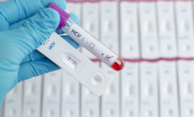 Ηπατίτιδα C