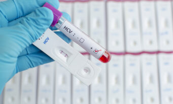 Ηπατίτιδα C