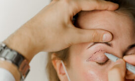 βλεφαροπλαστική