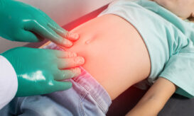 Ομφαλοκήλη