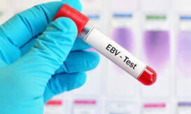 Έπσταϊν Μπαρ