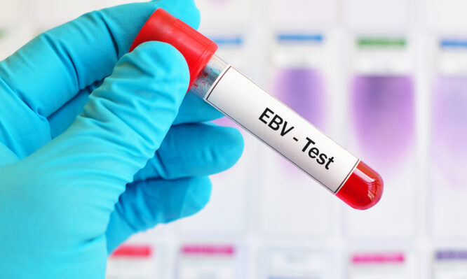 Έπσταϊν Μπαρ