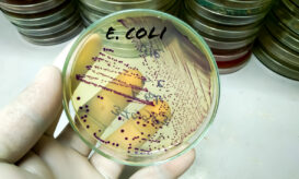 E.coli