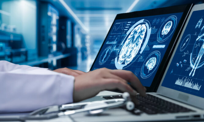 Αλτσχάιμερ