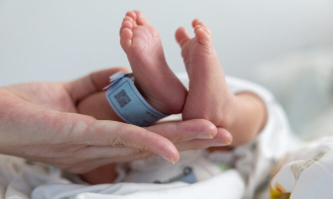 μεταμόσχευση