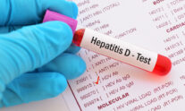 ηπατίτιδα D
