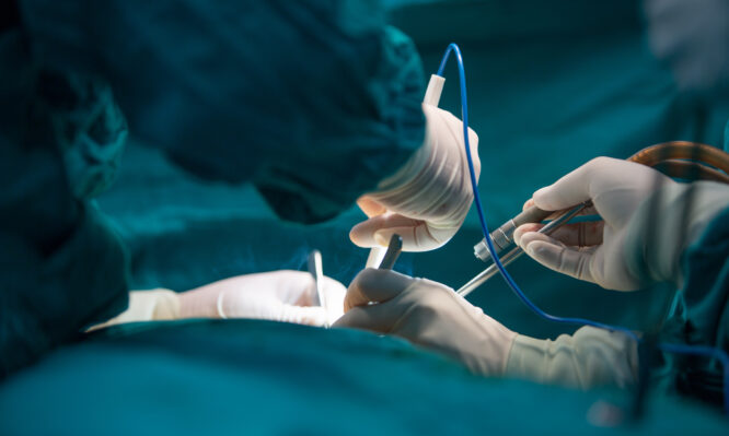 μεταμόσχευση