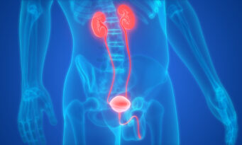 αχρωματοψία, καρκίνος