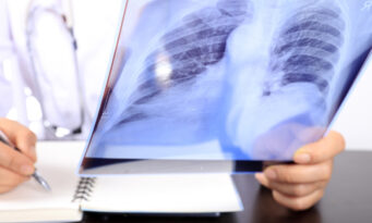 καρκίνος του πνεύμονα