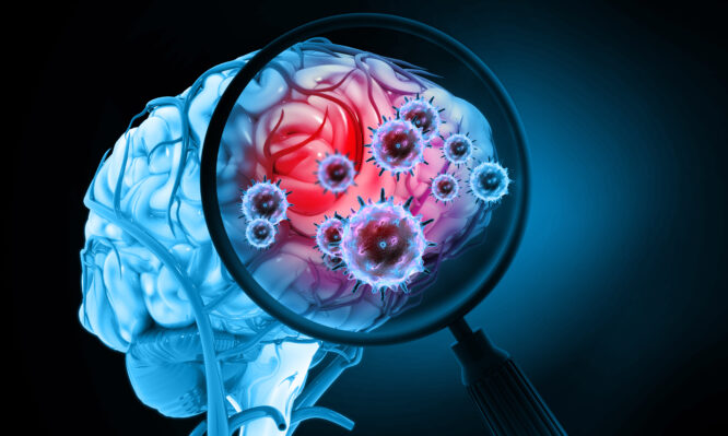 μηνιγγίτιδα