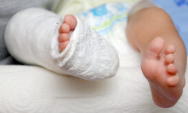 οστεομυελίτιδα